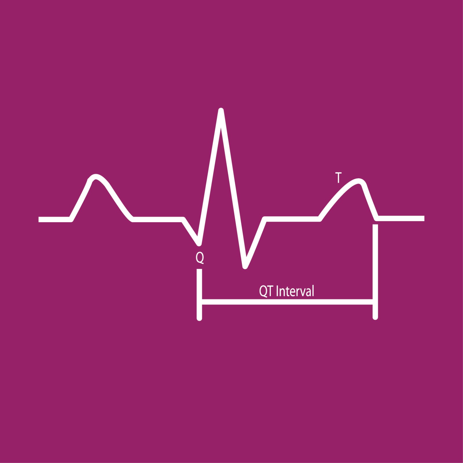 Congenital Long QT Syndrome